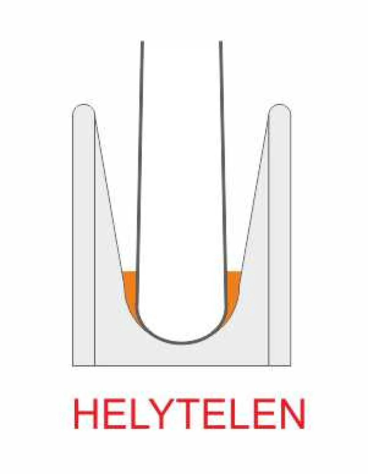 Túl tág koronghorony profil (Helytelen) Acélsodronykötél ellaposodása a túl tág alátámasztás nélküli kötélkorong horonyban